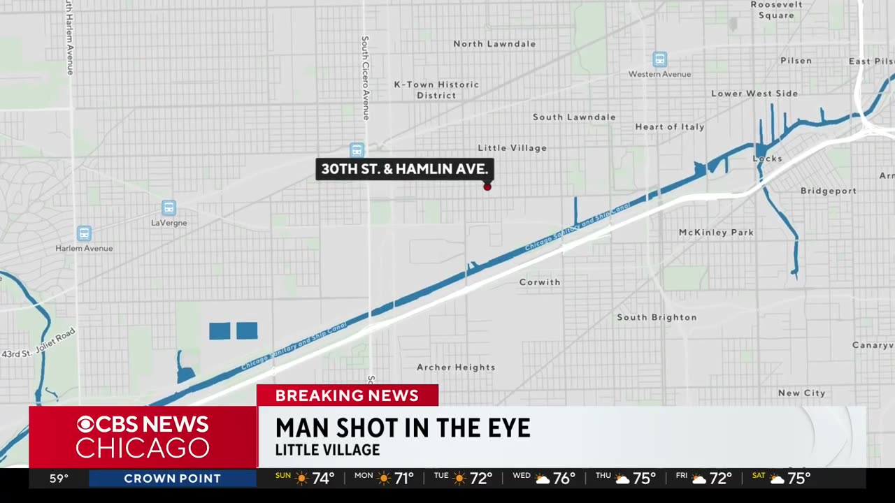 Man shot in eye in Little Village, police say