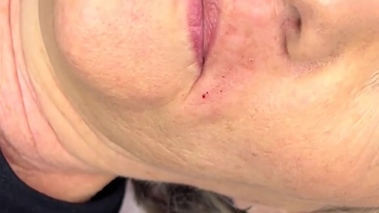 Upper Lip Waxing with Cherry Desire Hard Wax | Virginia Esthetician Demo @lawlesslybarellc