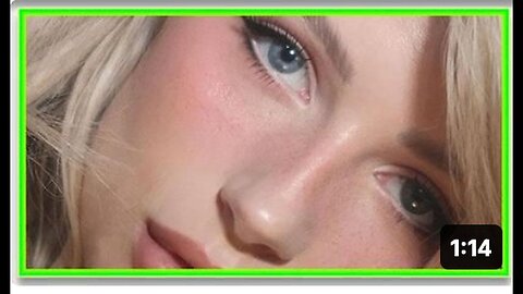 "OZEMPIC Induced Seizures Lead to Hospitalization of Model"
