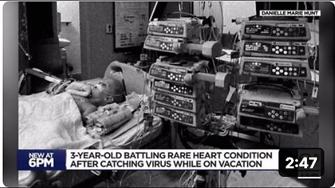 "Myocarditis Strikes 3-Year-Old Toddler..."