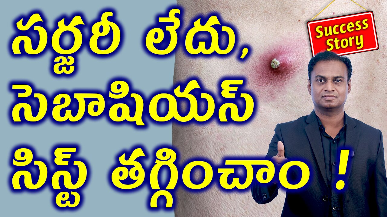 సర్జరీ లేదు, సెబాషియస్ సిస్ట్ తగ్గించాం Cured Sebaceous abscess Cyst without Surgery with Homeopathy