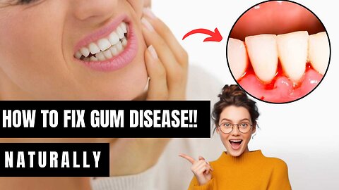 PRODENTIM REVIEWS ((😱REALLY WORKS 🤔)) Prodentim Supplement - Prodentim Ingredients