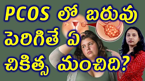 PCOS లో బరువు పెరిగితే ఏ చికిత్స మంచిది? Best Trusted Homeopathy Treatment for Obesity in PCOS Cure