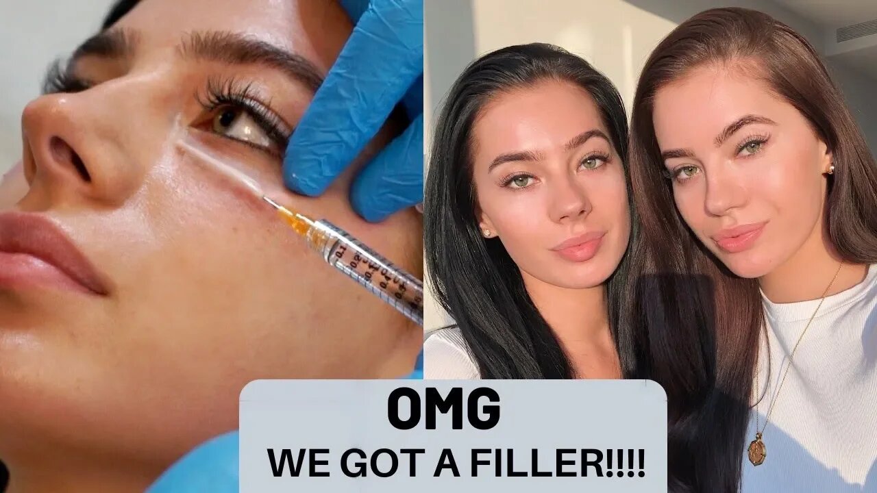 VLOG | GLOW UP!!! FIRST EVER FILLER - DERMAPEN FACIAL - LASH EXTENSIONS