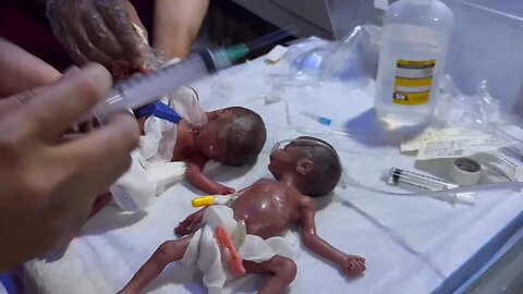 newbon twins baby iv line