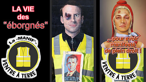 GILETS JAUNES _ Les "éborgnés" de la République 7 ans aprés...