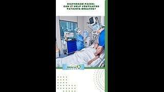 Diaphragm Pacer: Can It Help Ventilated Patients Breathe?