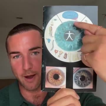 Heavy metal toxicity and iridology. No Rockefeller doctor needed 🌝