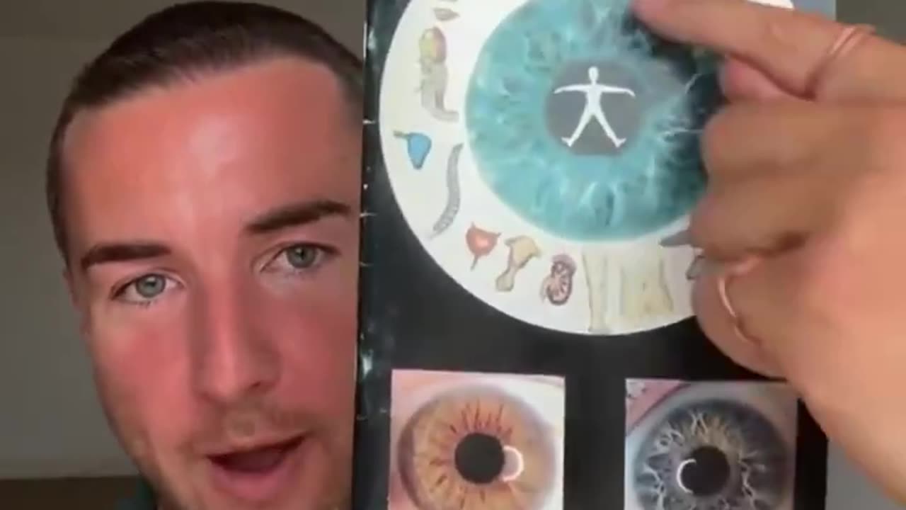 Heavy metal toxicity and iridology. No Rockefeller doctor needed 🌝