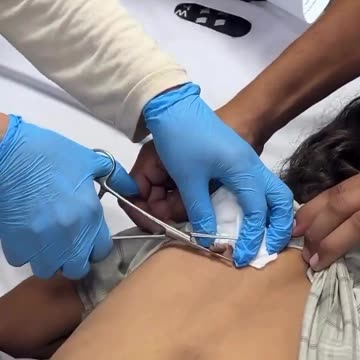 In Gaza: IDF Bullets Striking Victims With Casings Still Attached