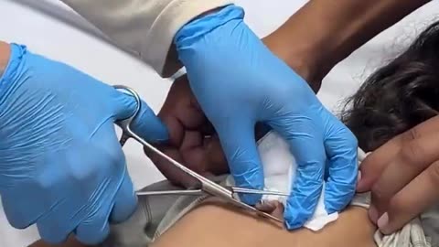 In Gaza: IDF Bullets Striking Victims With Casings Still Attached