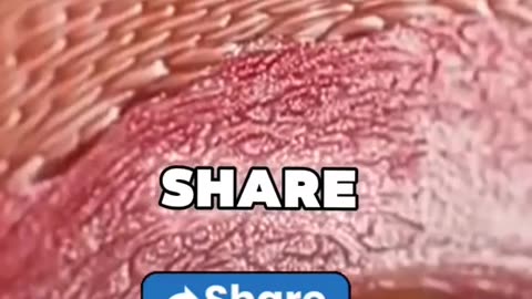 Melt Fat Naturally! The Secret Fat Burner You Need!