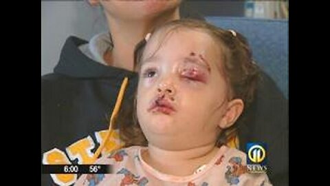 Kutyatámadás tarcalon! Postásra támadt a kutya! Ezt is a jegyző támogatja! Teljes változat!!