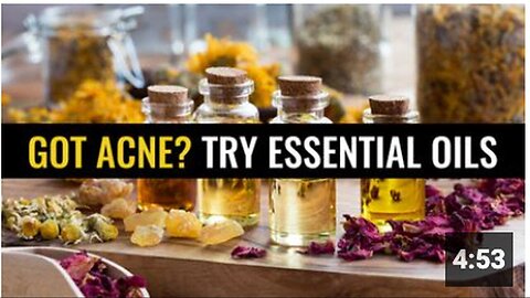 "Essential Oils: An Effective Solution for Acne"