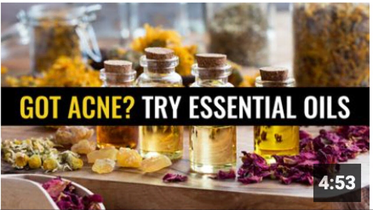 "Essential Oils: An Effective Solution for Acne"