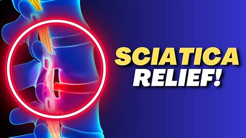 5 Easy Sciatica Exercises for Fast Relief