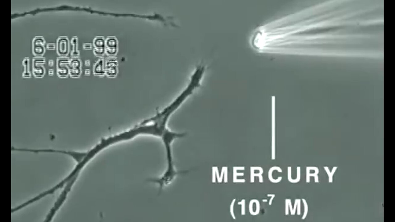 How Mercury Kills the Brain - Autism CURE:RAW MILK