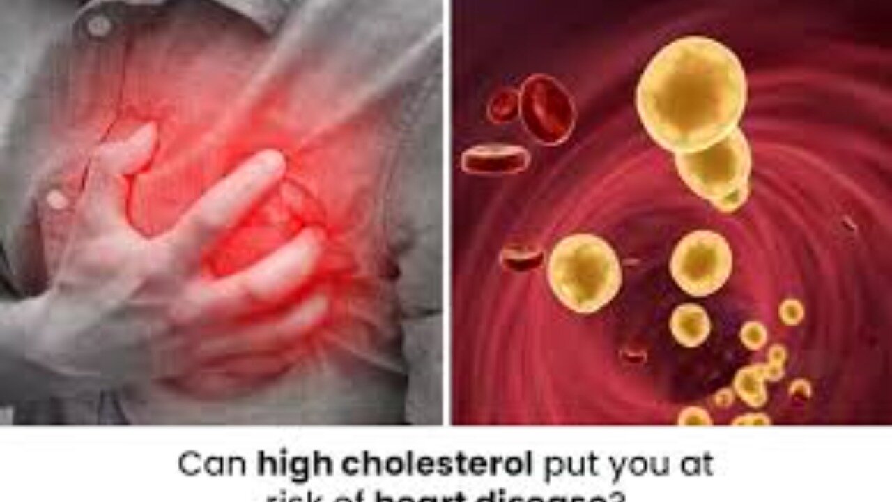 Cardiologist Dr Malhotra Reacts to Cholesterol LDL and Heart Disease Research Data