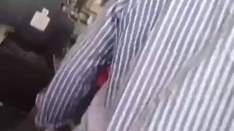 Woman got scalped at factory