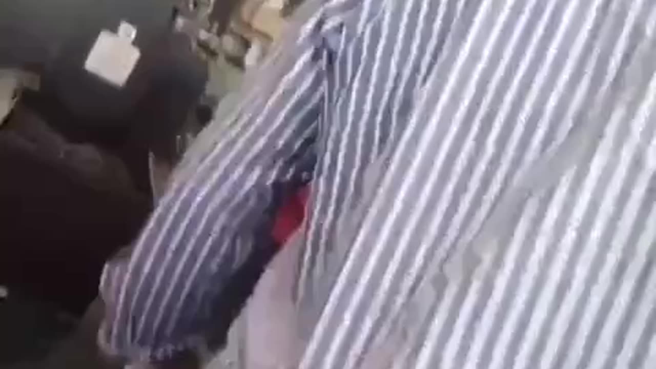 Woman got scalped at factory