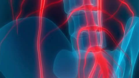 Kidney Stones Removal | Expert Urologist in Madurai