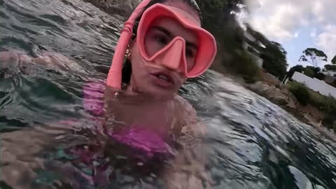 A Jellyfish Stings Me on the Face