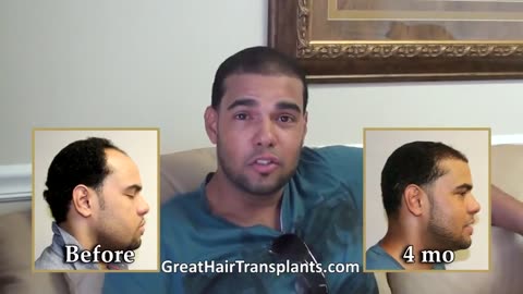 Great Hair Transplants: Dr. Brett Bolton Achieves Scar-Free Results