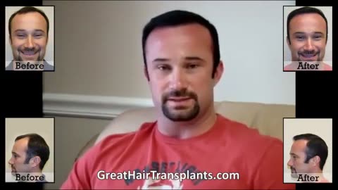 Here We Go Again: Dr. Brett Bolton’s Latest Hair Transplant Success