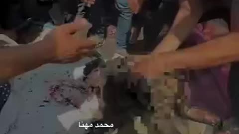 Gaza’s Children Burn While the Muslim World Stays Silent — Iran Stands Alone in True Resistance
