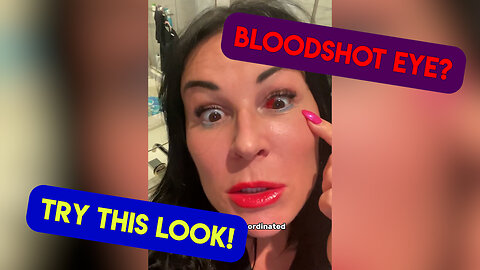 Bloodshoot Eye Hack