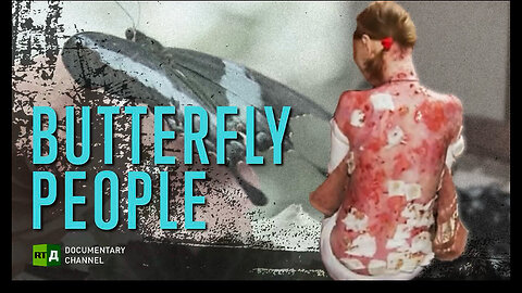 "Butterfly People: An Examination of Individuals Inspired and Transformed by Nature"