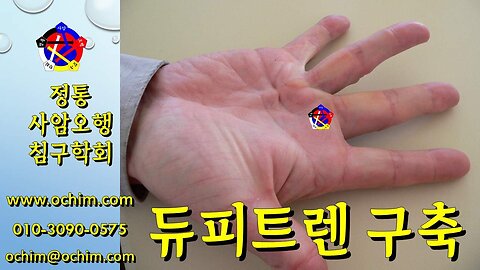 듀피트렌 구축 원인과 치료방법 - 사암오행침, 사암침법, 오행침, 정통사암침