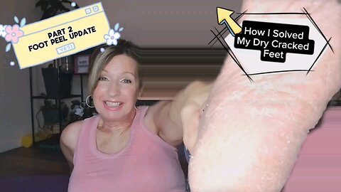 Part 2 of How to do a foot peel for Dry Cracked Feet