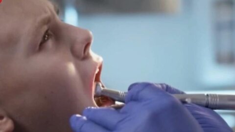 "Unveiling the Prolonged Use of Amalgam: Why Mercury Fillings Remain Acceptable in Modern Dentistry"