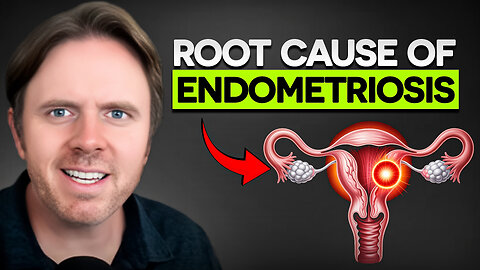 Endometriosis Explained Functional Medicine Root Cause Approach