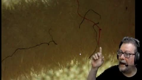 MORGELONS - Nanotecnologia de Grafeno, en Isopos, vacunas, anestesias, etc