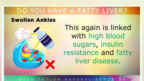 How Do You Know If You Have A Fatty Liver?