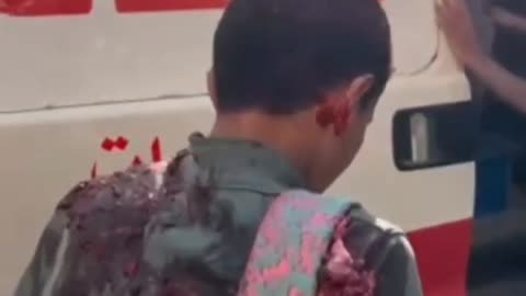 The remains on the child’s back belong to another person’s head (Graphic)