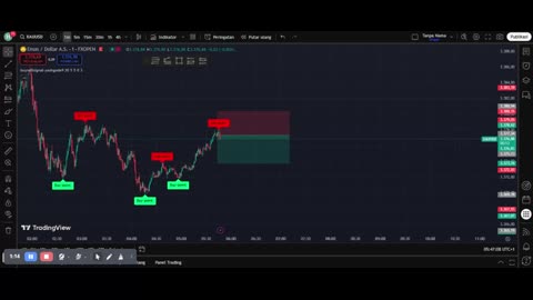 Learn Forex Scalping in 10 Minutes – Beginner Friendly