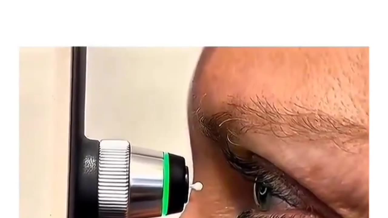 HOW DOCTORS DETECT EYE PRESSURE