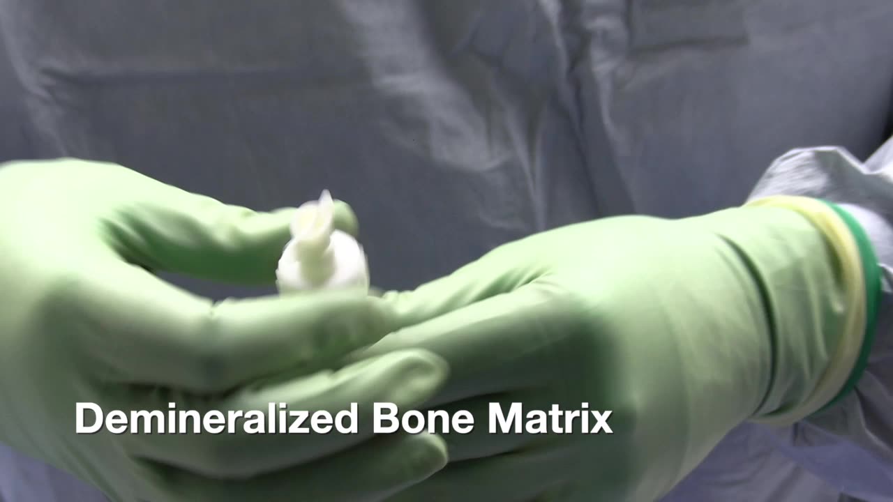 Demineralized Bone Matrix