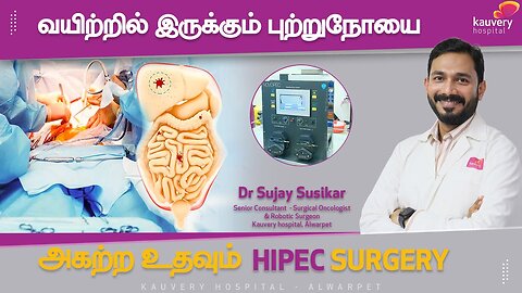 How Does HIPEC Technology Remove Cancer Cells from the Stomach?