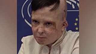 Translator SOBS While Speaking for Injured Ukrainian Boy Who Lost Mom in Russian Attack