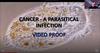 Dr Lee Merritt Insights of Cancer, Parasites, Spike Proteins, Cysts 04-Aug-2025