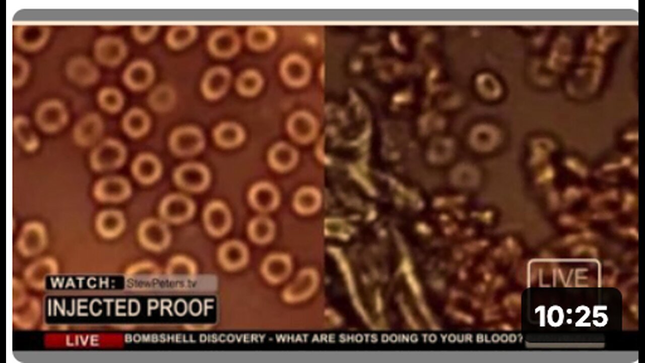 "Dr. Jane Ruby Proves 'Blood' Poison Injection on Stew Peters Show"