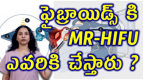ఫైబ్రాయిడ్స్ కి MR HIFU ఎవరికి చేస్తారు? Painless Faibroids Removal Advanced Ultrasound Surgery