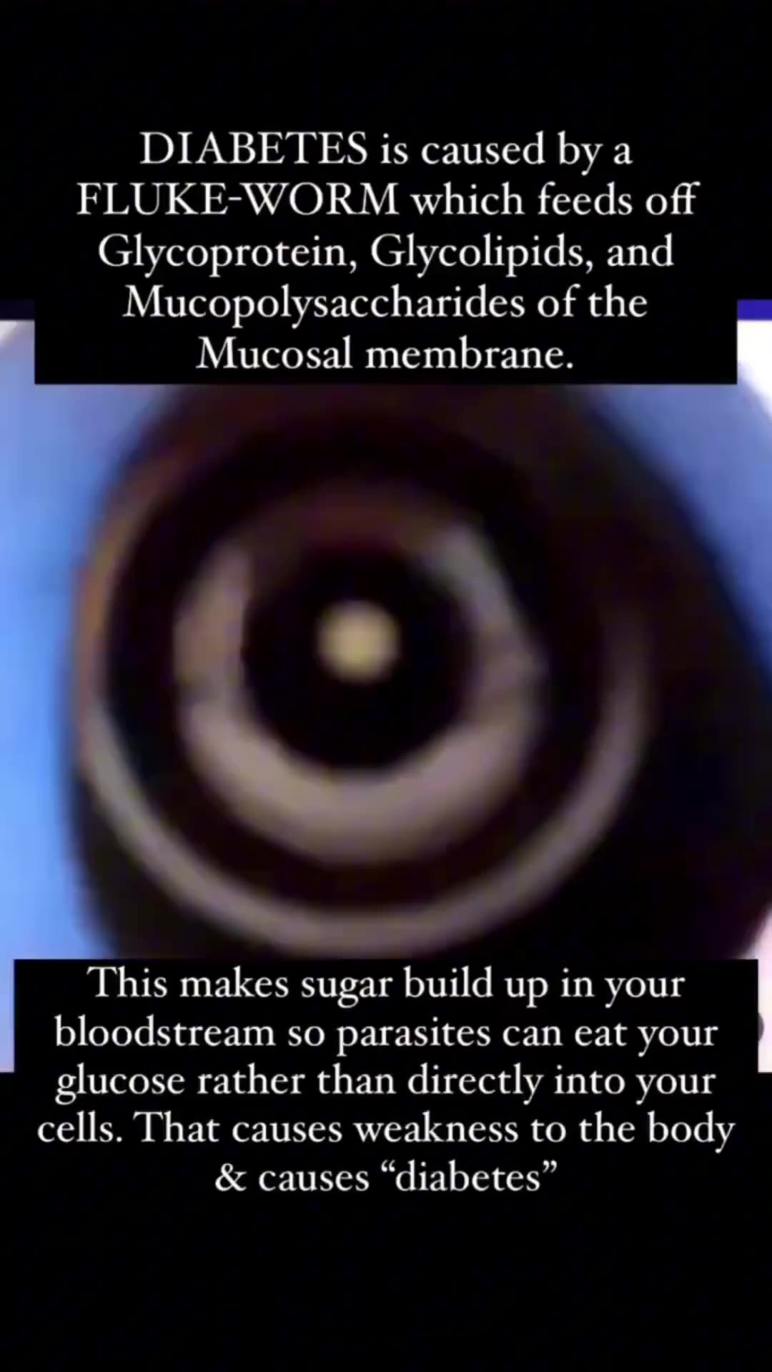 DIABETES A disease caused by a parasite called the FLUKE-WORM which feeds...