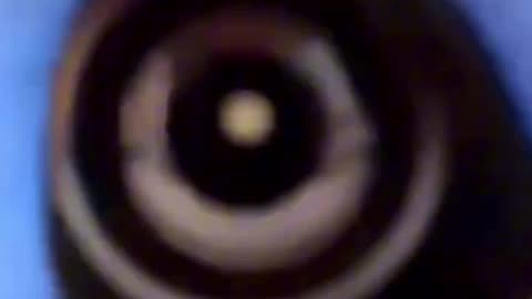 DIABETES A disease caused by a parasite called the FLUKE-WORM which feeds...