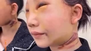 Human trafficking - Older people in China are getting their face replaced.