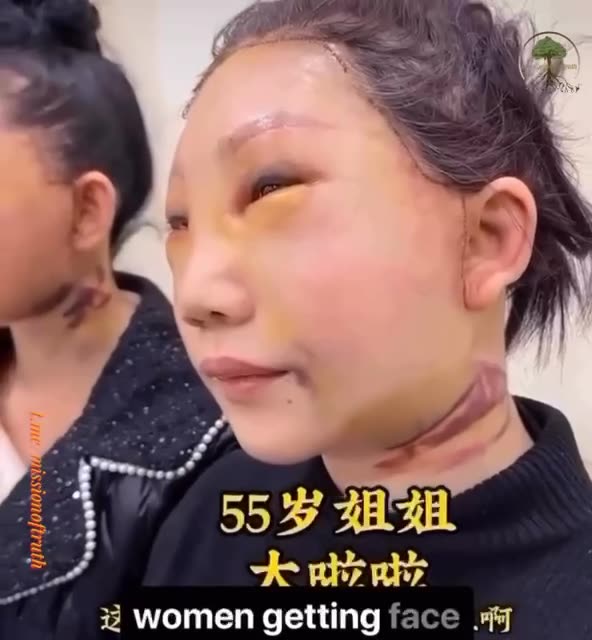 Human trafficking - Older people in China are getting their face replaced.